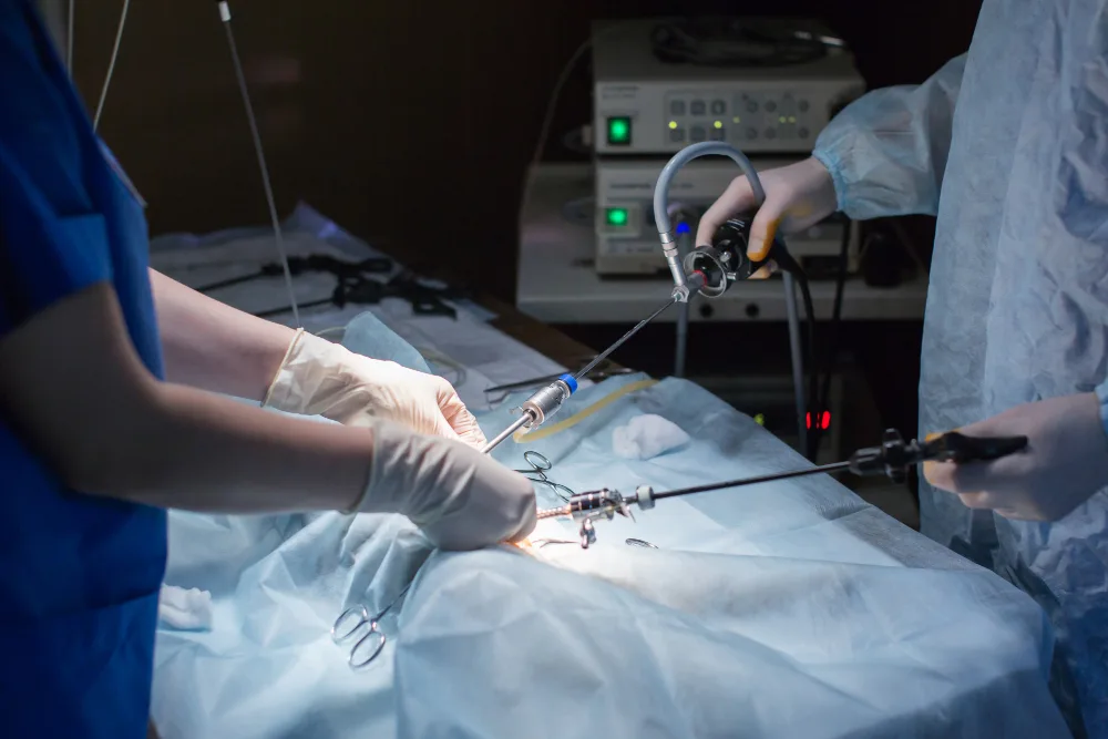 Laparoscopic Surgery in Cancer Treatment: Advantages and Applications